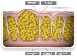 ما هو السيلوليت - ازاى تتخلص من المشاكل الى فى جسمك 3576 1