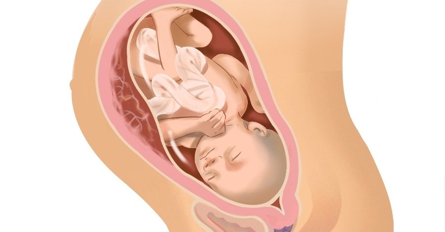 الاسبوع الثلاثين من الحمل بالصور , واهم اعراض الحمل ومراحل نمو الجنين