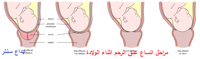 الخياطة بعد الولادة الطبيعية بالصور , الولاده الطبيعيه وما بعدها