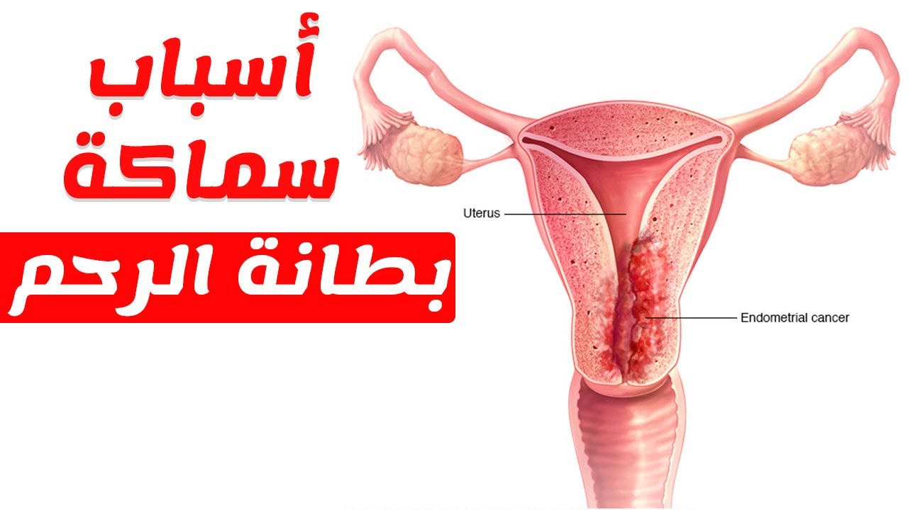 بطانة الرحم والحمل , والحفاظ والوقايه علي بطانه الرحم