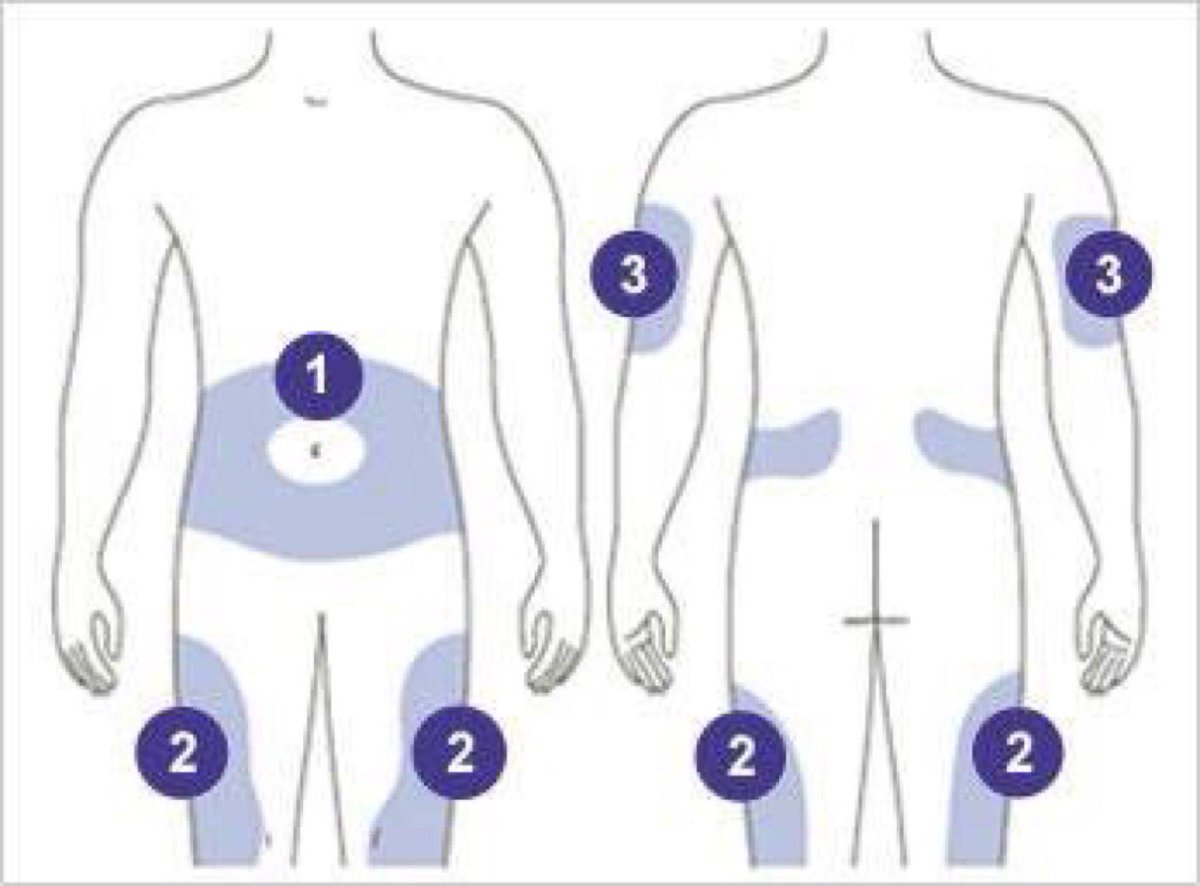 اماكن حقن الانسولين بالصور - اماكن الحقن صحيحة حقا 11225 4