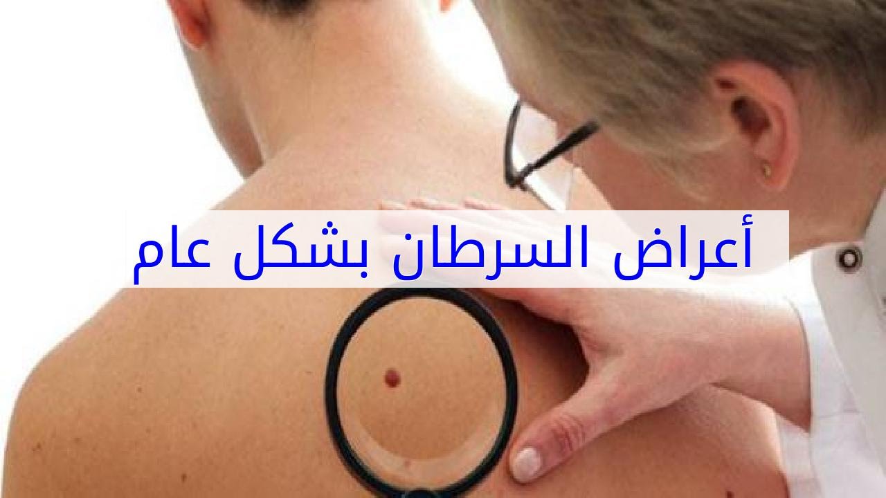 اعراض السرطان بشكل عام , تعرف على علامات بداية مرض السرطان