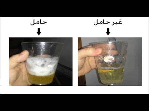 اختبار الحمل المنزلي بالكلور , طريقة تحليل الحمل بالكلور