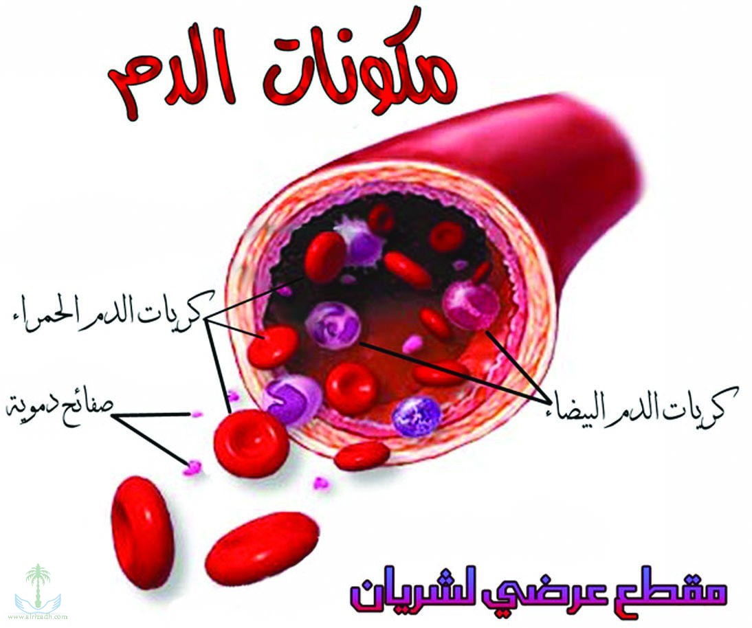 ماهو تكسر الدم , وماهي اسبابه