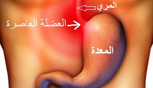 علاج الحموضه والحرقان للحامل , الحموضه وعلاجها بالخضار