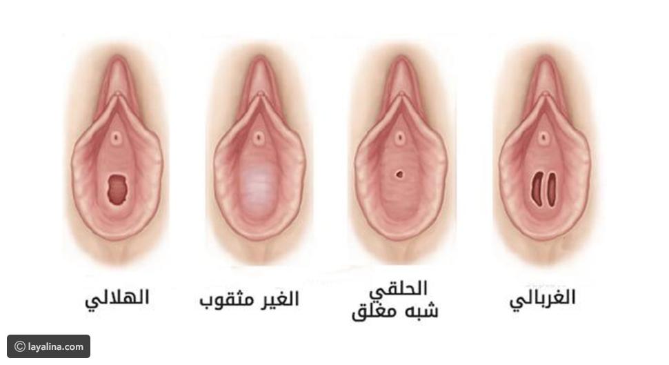 شكل الرحم قبل الزواج – شكل الرحم مختلف تماما