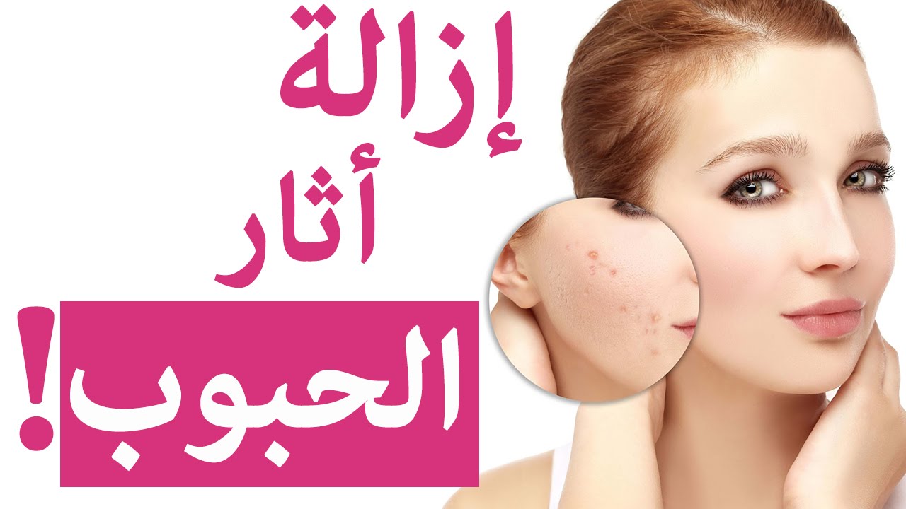 خلطة لازالة الحبوب , طريقة التخلص من حبوب الوجه