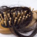 2210 2 المعدل الطبيعي لتساقط الشعر - اعرف نسبه تساقط الشعر هند