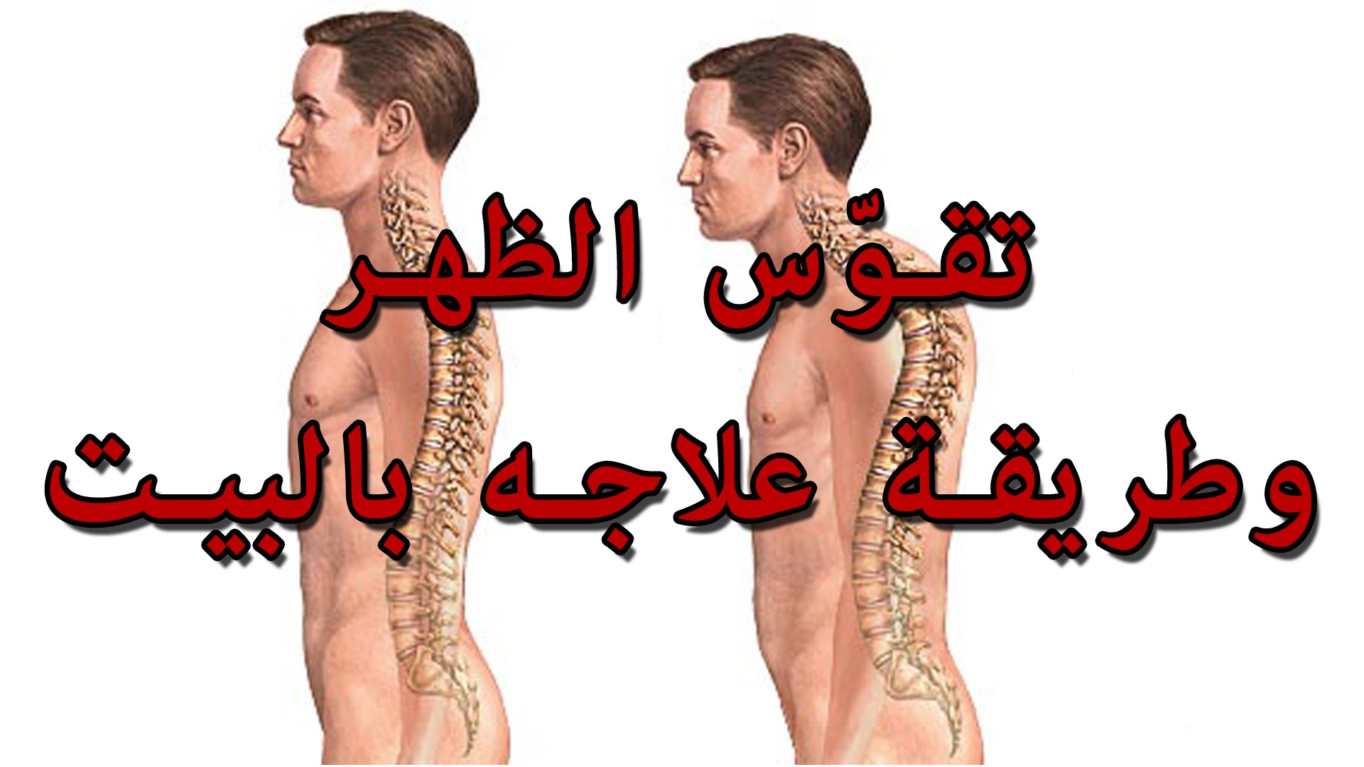 علاج تقوس الظهر , ماهي اسباب الاصابه بالتقوس الظهر والعلاج