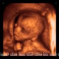 4622 10 شكل الجنين في الشهر السادس بالسونار - حجم الجنين خلال اشهر الحمل صفاء منير