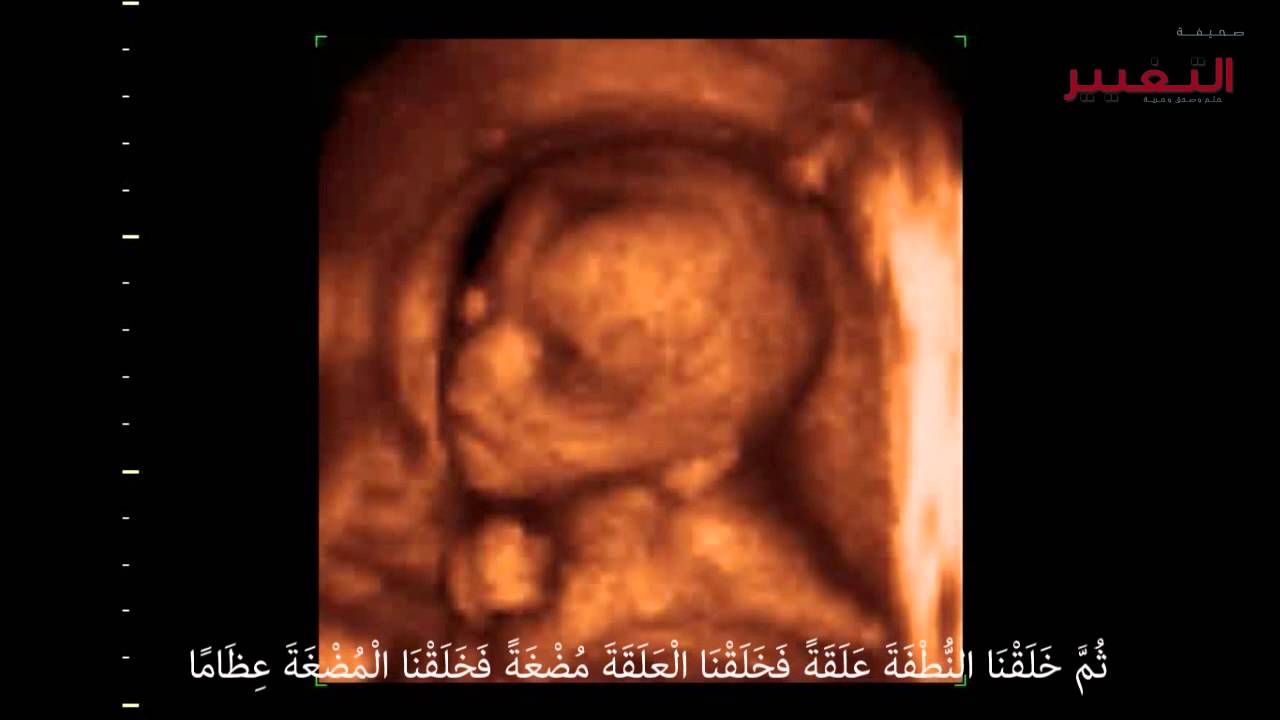4622 شكل الجنين في الشهر السادس بالسونار - حجم الجنين خلال اشهر الحمل صفاء منير