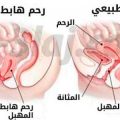 6536 2 علاج نزول الرحم - اسباب نزول الرحم وطرق علاجه دعاء منصور