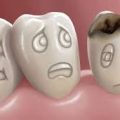 5958 2 علاج الم الاسنان للاطفال - طرق امنه لعلاج الم الاسنان عند الصغار خلود عدلي