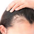 1812 2 علاج تساقط الشعر للنساء - وصفات طبيعية لعلاج الشعر يسرا شوقي