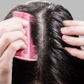 12369 3 علاج قشرة الشعر بالاعشاب - كيفية التخلص من القشرة فى الشعر طائش