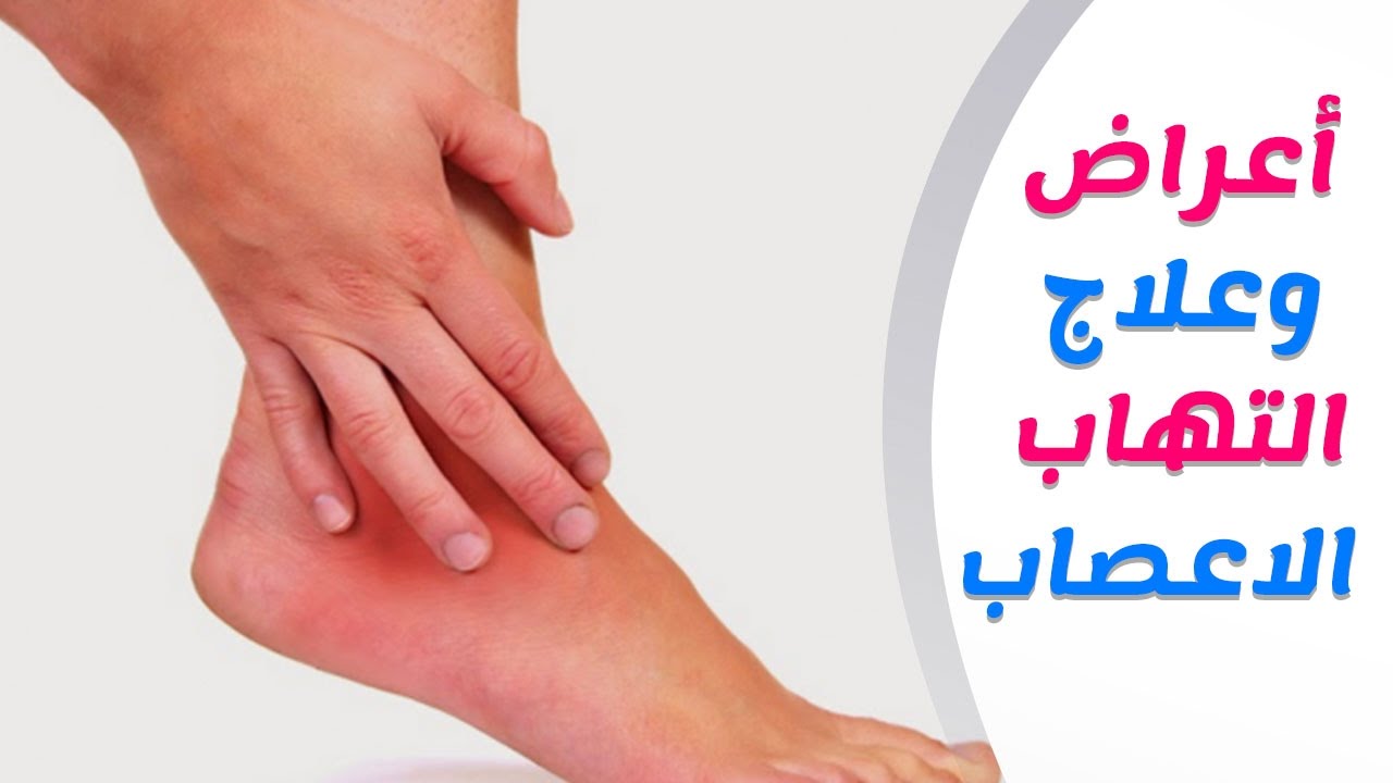 تلف الأعصاب علاجه بالأعشاب -علاج تلف الاعصاب بالاعشاب 13678 2