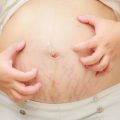 2517 3 ما هي حساسة الحمل -حساسية الحمل في الشهر الثامن طائش