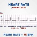2383 1 تخطيط القلب لها فوائد كثيره -فوائد تخطيط القلب طائش